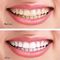 Natural Coconut Charcoal Teeth Whitening Powder Untuk Menghilangkan Noda Gigi